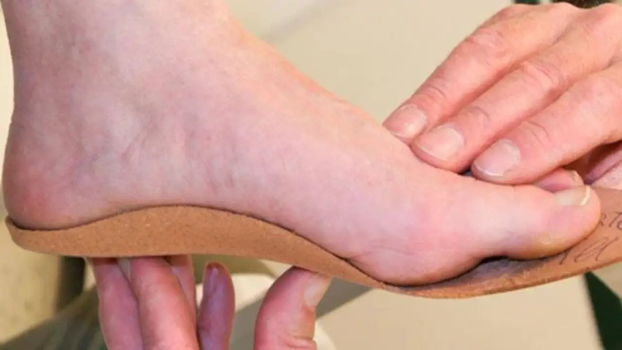 Assess Your Foot Type