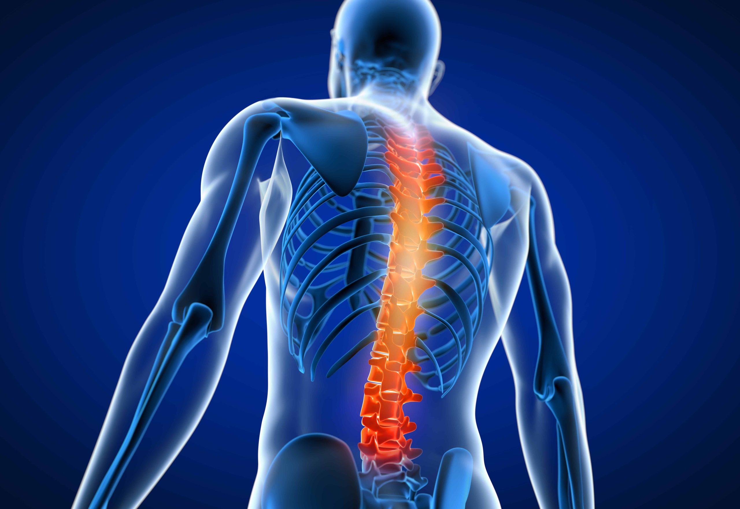 Common Causes Of Poor Spinal Alignment And Back Pain