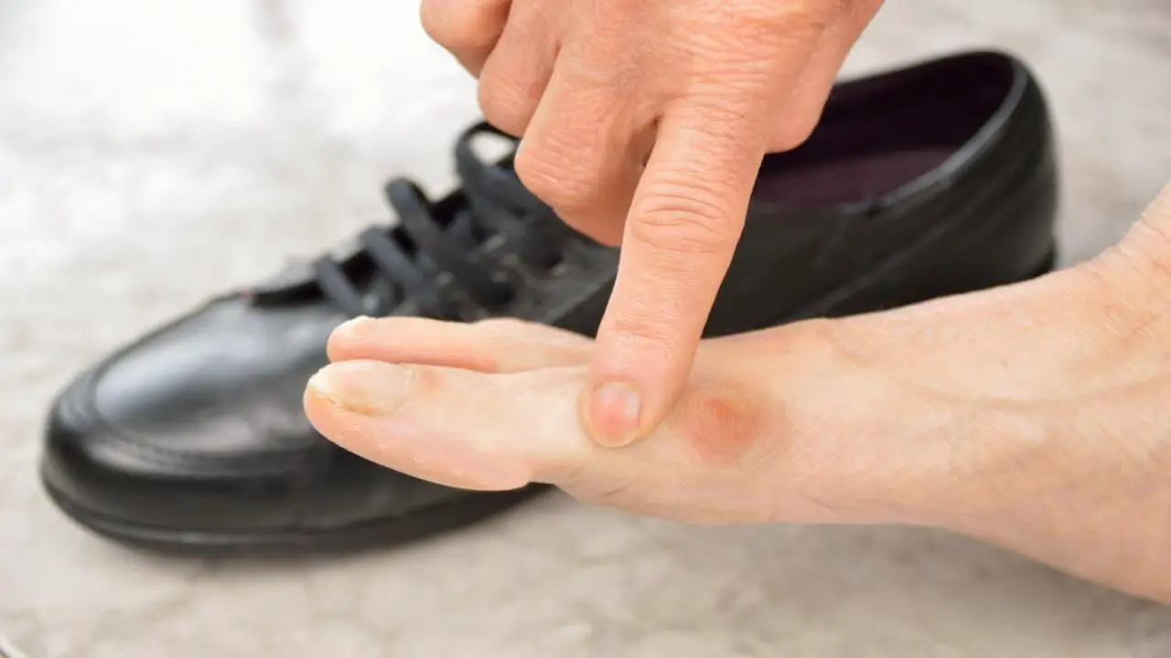 Common Foot Problems And Infections