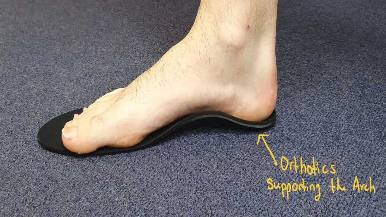 Support For Individuals With Flat Feet Or High Arches