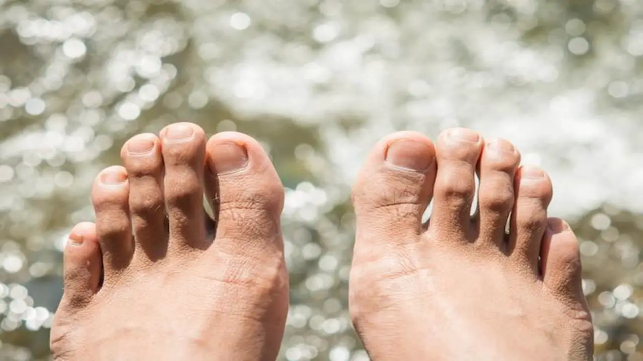 The Impact Of Diabetes On Foot Health