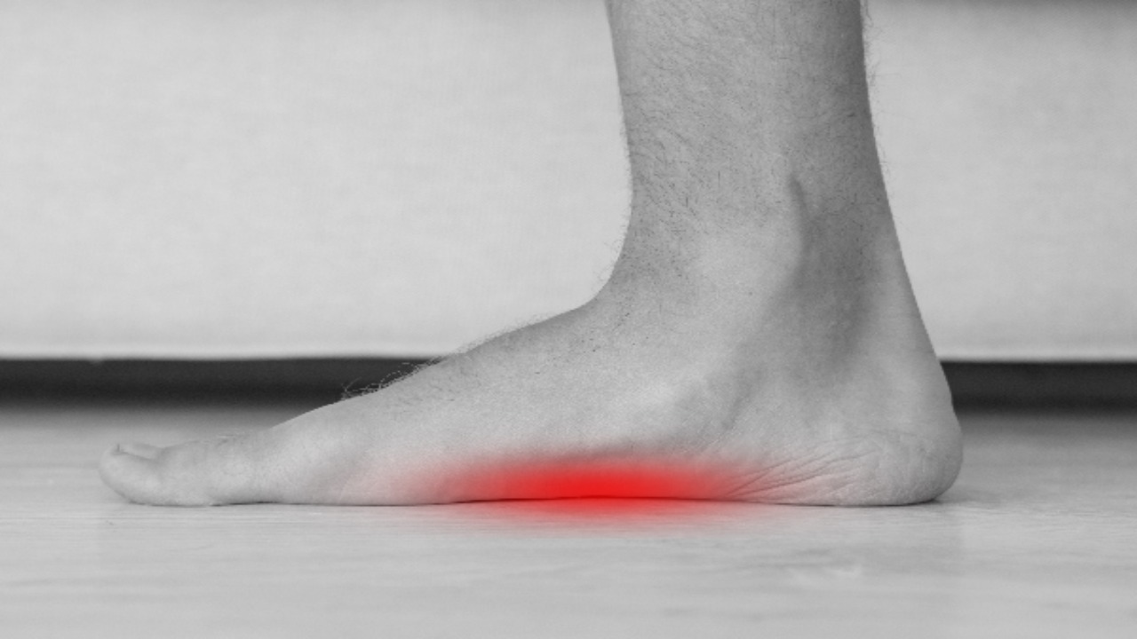 What Causes Fallen Arches And Flat Feet