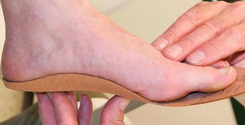 What To Consider When Choosing Orthotic Insoles For Arch Support